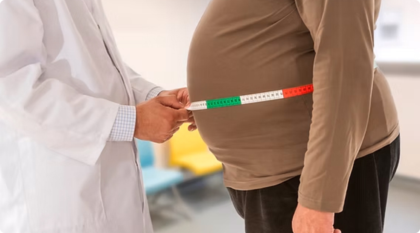 Essentials of Obesity Management